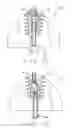 Fig. 03 - Fuel nozzle servicing tool