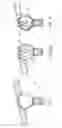 Fig. 08 - Foldable joint for baby stroller