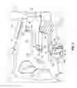 Fig. 04 - Delordosation device