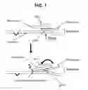 Fig. 02 - Suspension for protecting a component from mechanical shock