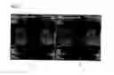 Fig. 06 - Correction of distortions in diffusion-weighted magnetic resonance imaging