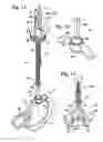 Fig. 09 - Anchor bolt providing for fall protection