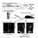 Fig. 01 - Restoration of hearing loss
