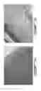 Fig. 09 - Composition and method for the repair and regeneration of cartilage and other tissues