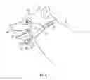 Fig. 02 - JAW HOLD OPEN APPARTUS