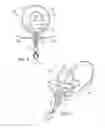 Fig. 07 - JAW HOLD OPEN APPARTUS