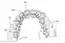 Fig. 01 - Method for designing orthodontic apparatus