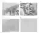 Fig. 01 - Method for detection of idiopathic interstitial pneumonia