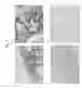 Fig. 02 - Method for detection of idiopathic interstitial pneumonia