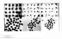 Fig. 11 - DEVICES AND METHODS FOR PRODUCTION OF CELL AGGREGATES