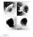 Fig. 27 - DEVICES AND METHODS FOR PRODUCTION OF CELL AGGREGATES