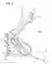 Fig. 03 - Simulated climbing and full body exercise and method
