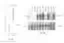 Fig. 05 - GENE EXPRESSION PROFILING OF PRIMARY BREAST CARCINOMAS USING ARRAYS OF CANDIDATE GENES