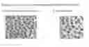 Fig. 04 - METHODS TO INCREASE PERMEABILITY OF CORNEAL EPITHELIUM AND DESTABILIZE STROMAL COLLAGEN FIBRIL NETWORK
