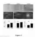 Fig. 04 - Compositions and methods for treating neurodegenerating diseases