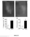 Fig. 20 - Compositions and methods for treating neurodegenerating diseases