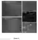 Fig. 22 - Compositions and methods for treating neurodegenerating diseases
