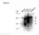 Fig. 04 - DNA sequence encoding a retinoic acid regulated protein
