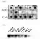 Fig. 05 - DNA sequence encoding a retinoic acid regulated protein