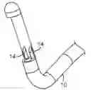 Fig. 01 - Method and device for uterine fibroid treatment