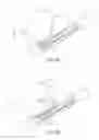 Fig. 04 - Method and device for uterine fibroid treatment