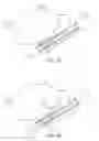 Fig. 06 - Method and device for uterine fibroid treatment