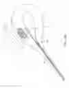 Fig. 09 - Method and device for uterine fibroid treatment