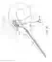 Fig. 10 - Method and device for uterine fibroid treatment