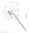 Fig. 12 - Method and device for uterine fibroid treatment