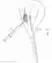 Fig. 19 - Method and device for uterine fibroid treatment