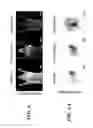 Fig. 09 - System and method for normalized diffuse emission epi-illumination imaging and normalized diffuse emission transillumination imaging