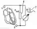 Fig. 01 - Method and device for using impedance measurements based on electrical energy of the heart