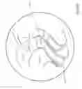 Fig. 13 - EXTENDABLE SPECIMEN COLLECTING DEVICE