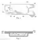Fig. 02 - Short stretch therapeutic compression device for the extremity and method