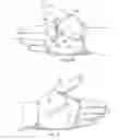Fig. 04 - Short stretch therapeutic compression device for the extremity and method