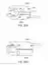 Fig. 20 - METHODS AND SYSTEMS FOR TREATMENT OF ACUTE ISCHEMIC STROKE