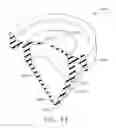 Fig. 49 - Trocar Assembly