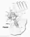 Fig. 02 - Trocar and cannula assembly having improved conical valve, and methods related thereto