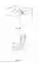Fig. 03 - Disposable urine bag device
