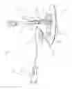 Fig. 02 - Infusion set
