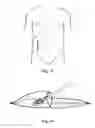 Fig. 07 - MULTIFUNCTION CARBASUS FOR LAPAROSCOPIC OPERATION