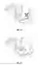 Fig. 08 - MULTIFUNCTION CARBASUS FOR LAPAROSCOPIC OPERATION