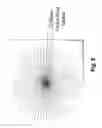 Fig. 07 - Method and apparatus for universal improvement of vision