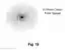 Fig. 09 - Method and apparatus for universal improvement of vision