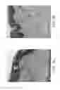 Fig. 08 - Apparatus and method for adjustable fractional optical dermatological treatment