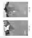 Fig. 09 - Apparatus and method for adjustable fractional optical dermatological treatment