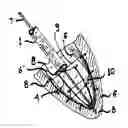 Fig. 01 - System for improving diastolic dysfunction