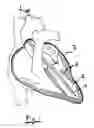 Fig. 02 - System for improving diastolic dysfunction