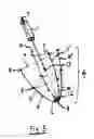 Fig. 04 - System for improving diastolic dysfunction