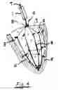 Fig. 05 - System for improving diastolic dysfunction